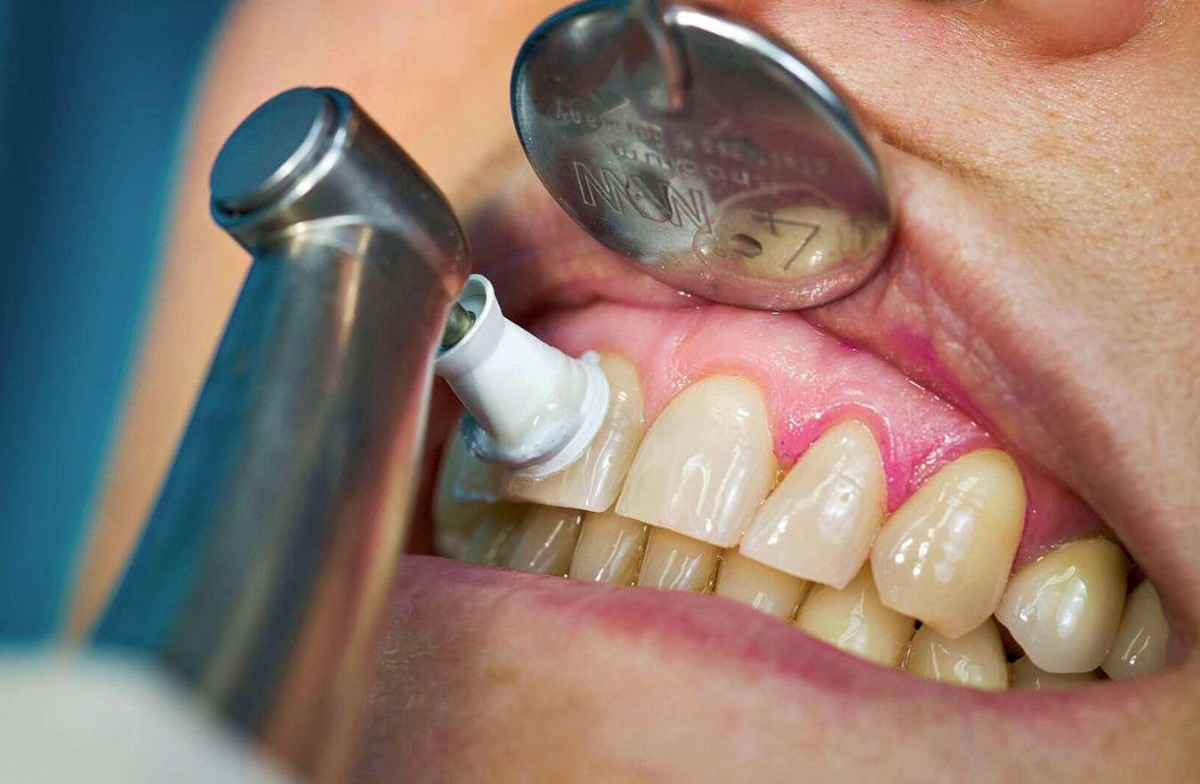 Zähne und Zahnfleisch gesund halten