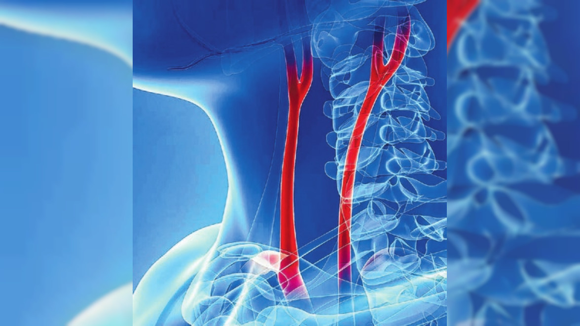 senken das Risiko deutlich. Über die Gefahren