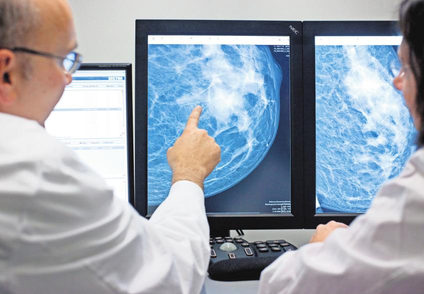 Brustkrebs-Vorsorge: 56 Prozent der Frauen nutzen Mammographie-Angebot-5