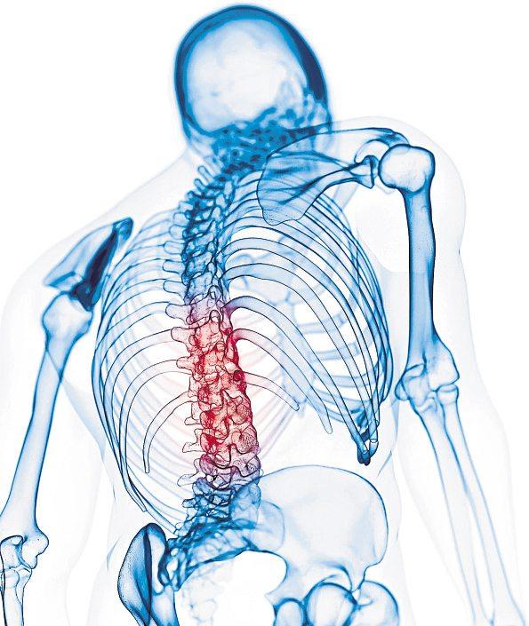 „Volkskrankheit“ Rückenschmerzen