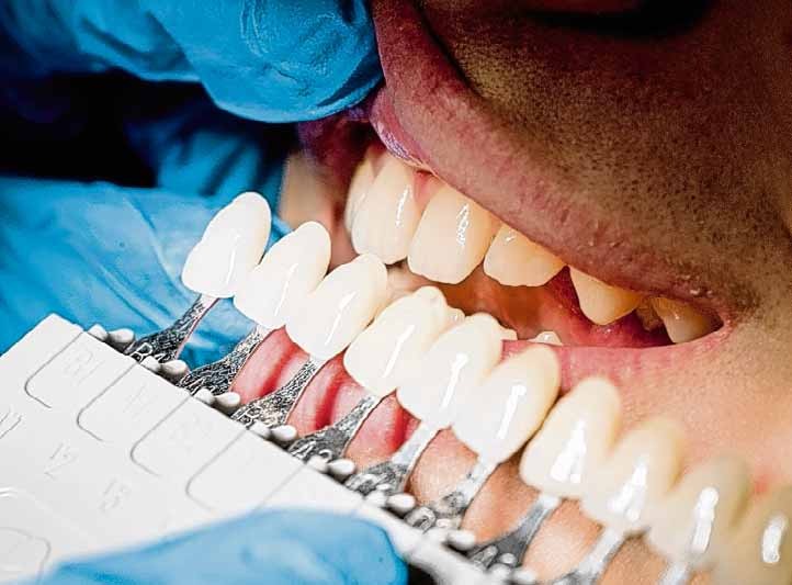 Wie gut kann Zahnpasta ohne Fluorid sein?-4