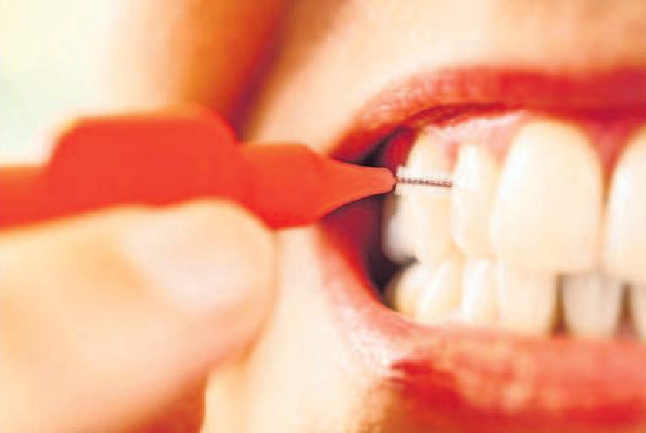 Tipps für die Mundhygiene-2