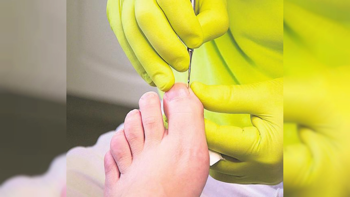 Fußpflege beim Podologen auf Rezept