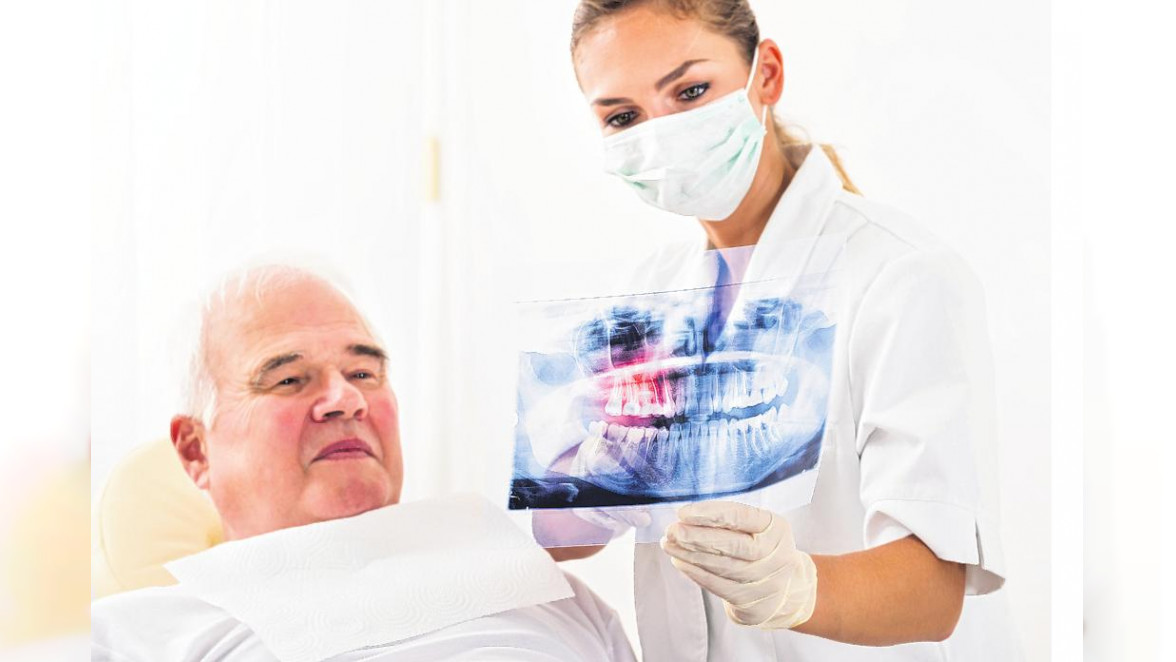 Zahnimplantate können einige Vorteile haben