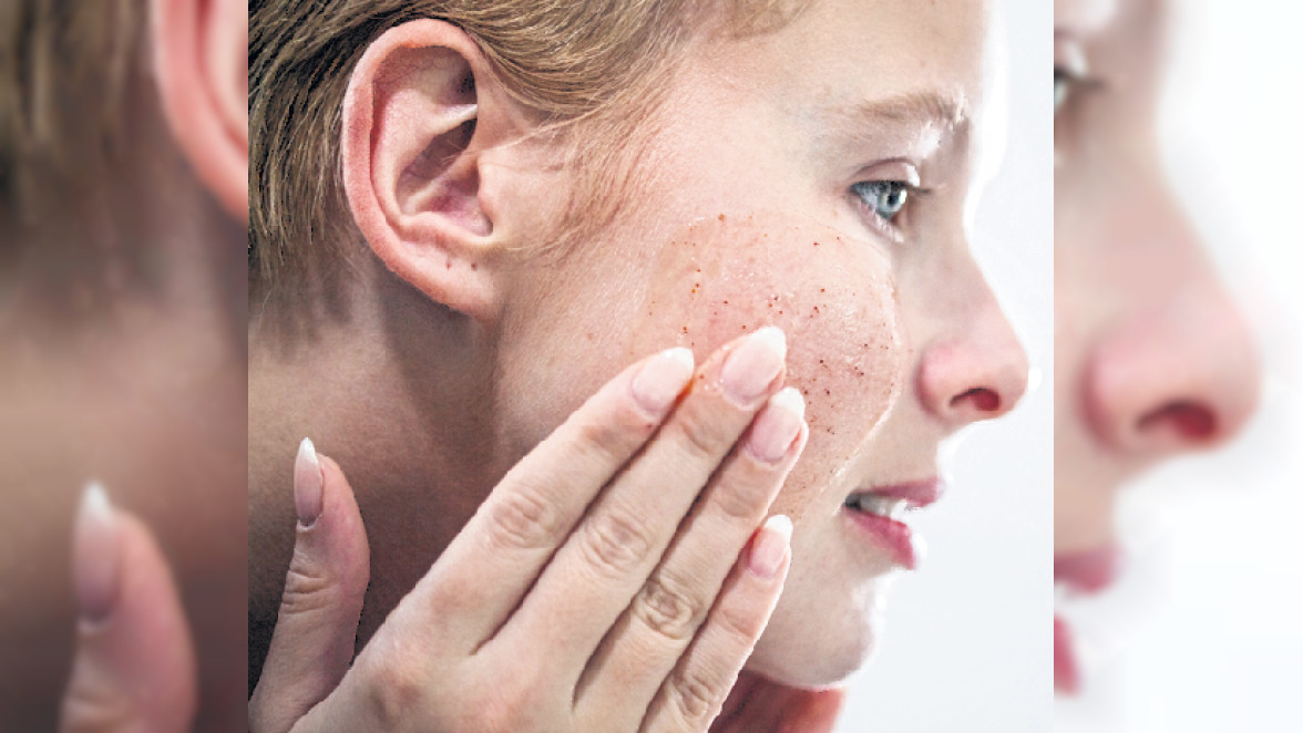 Bei gesunder Haut: Ein Peeling sorgt für Frische im Gesicht