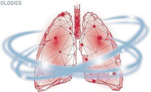 Bronchitis richtig behandeln