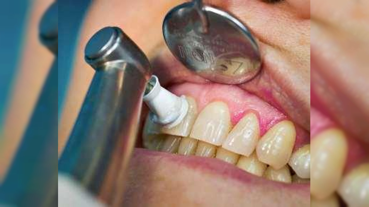 Zähne und Zahnfleisch gesund halten